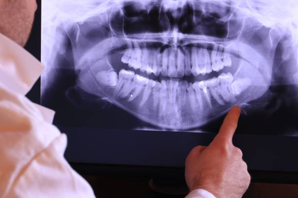 Best Emergency Care for Gum Disease in Palmetto, FL